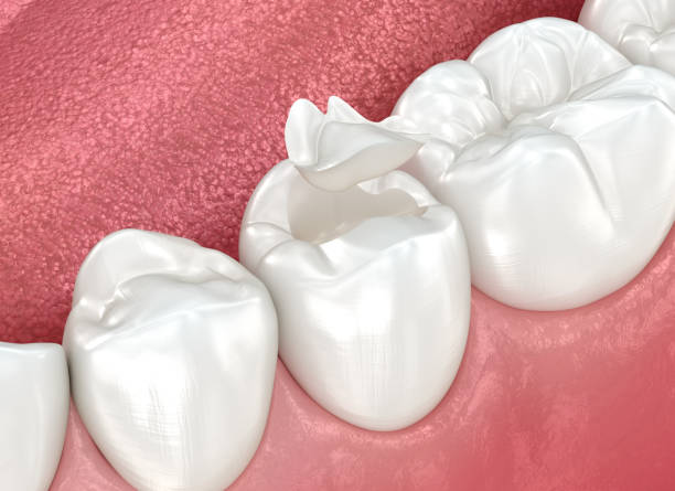 Best Cosmetic Dentistry  in Kewaskum, WI